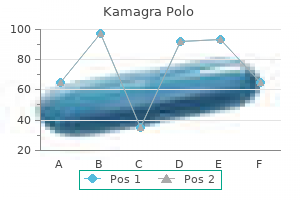 cheap 100 mg kamagra polo free shipping